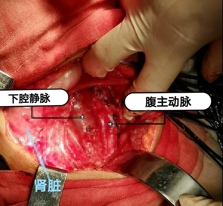 微信图片_20210513134815.jpg 微信图片_20210513134815.jpg